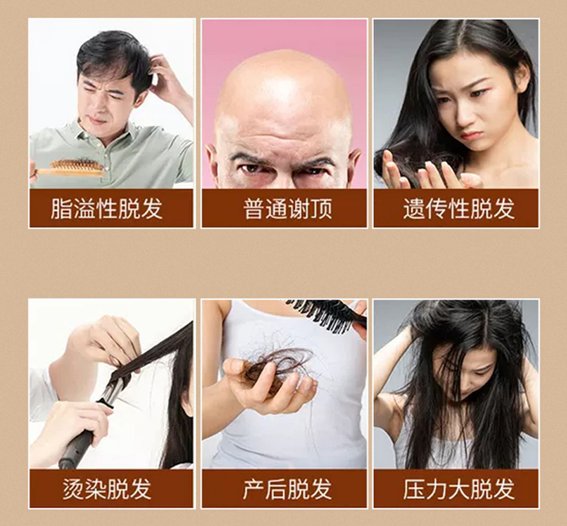 脫發(fā)的原因.jpg