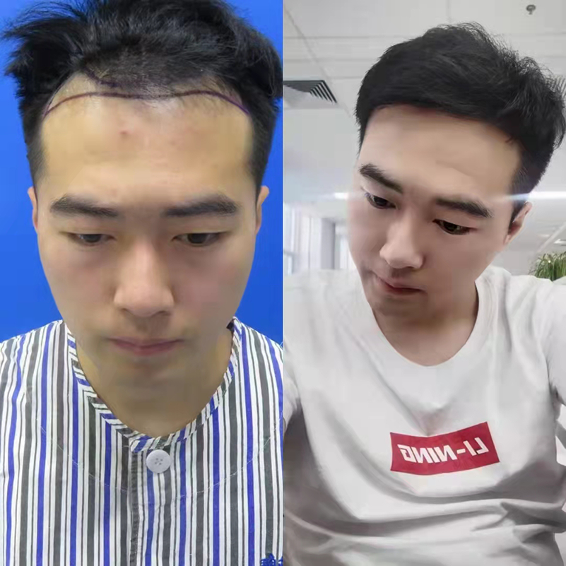 术åŽä¹?ji¨¦)个æ?png